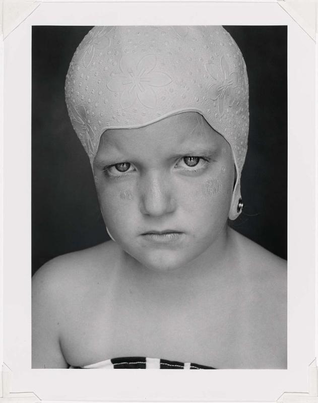 Finkle Girl with Sunburned Face, Millerton, New York
