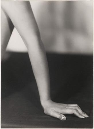 Arm