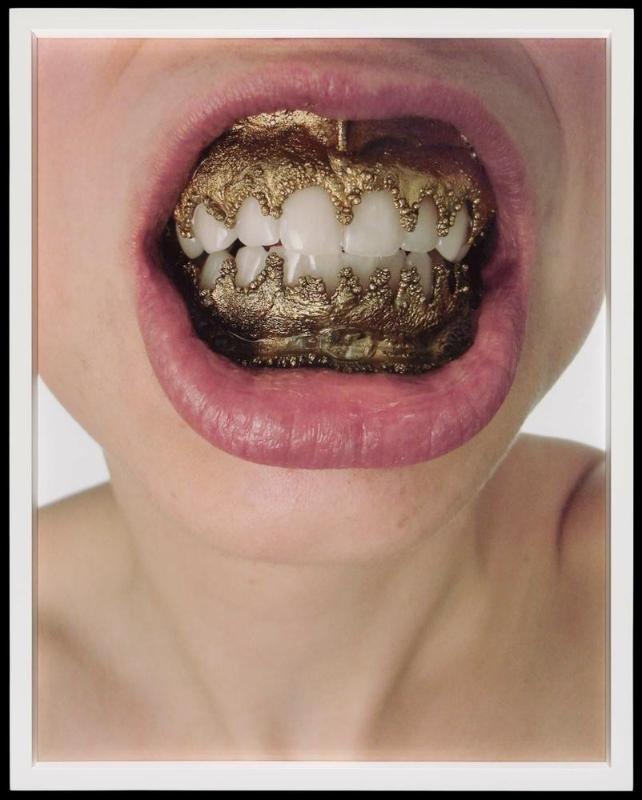 Oral Rims
