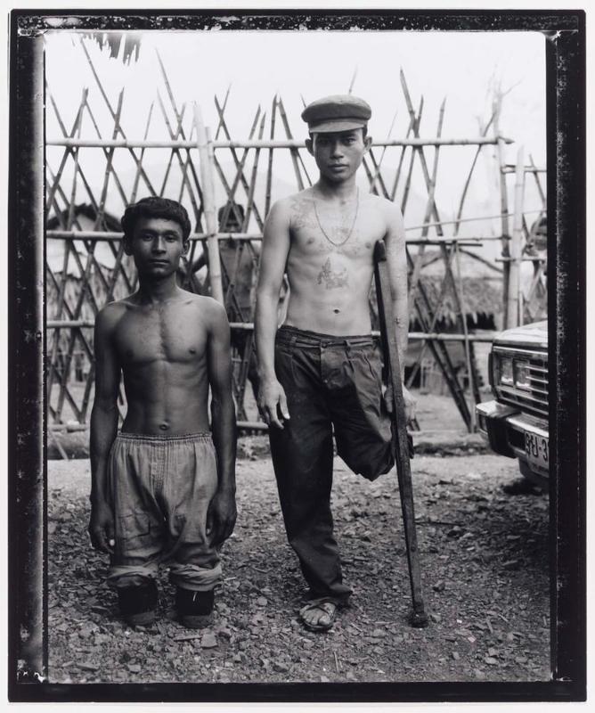 Two Khmer Rouge Amputees, Site 8