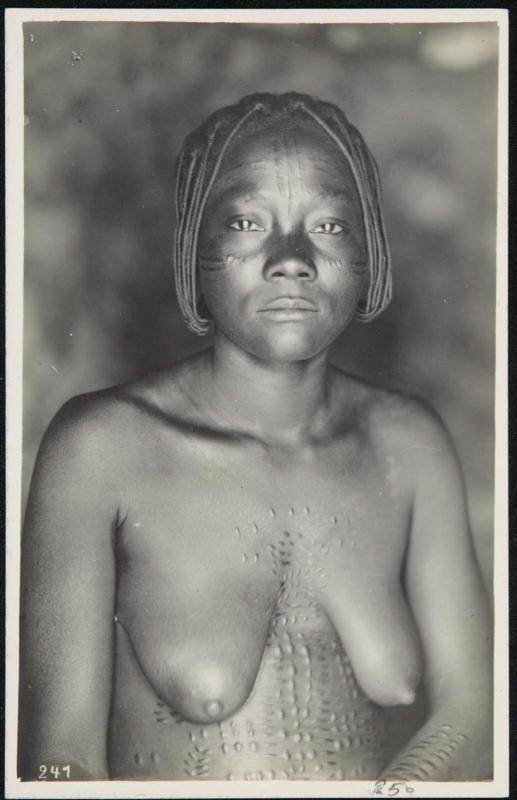 Half-length portrait of a woman with body scars