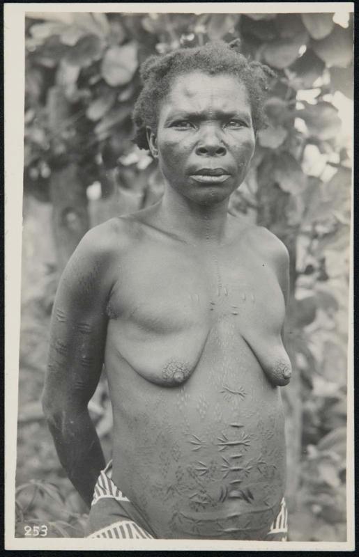 Half-length portrait of a woman with body scars