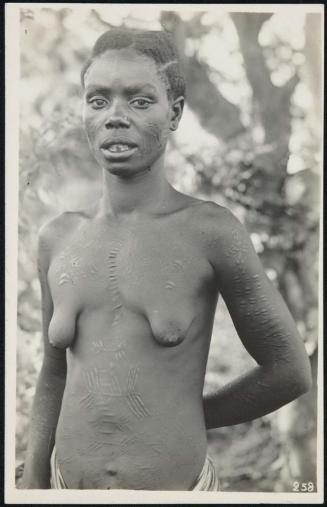 Half-length portrait of a woman with body scars