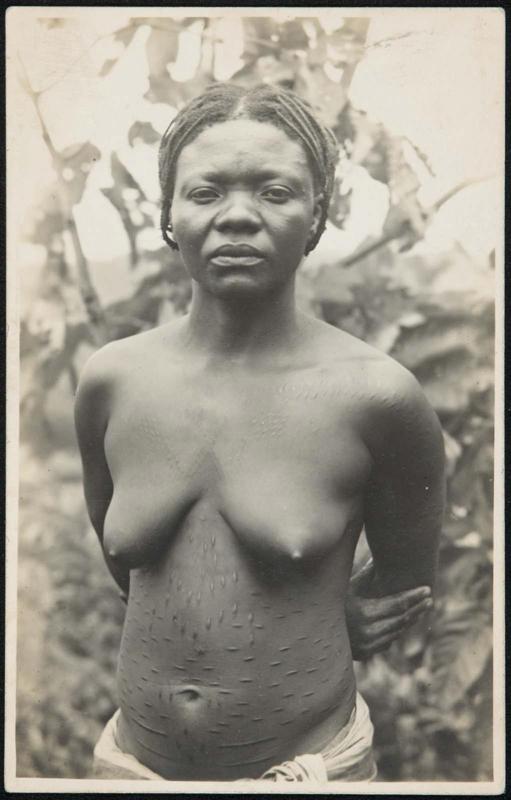 Half-length portrait of a woman with body scars