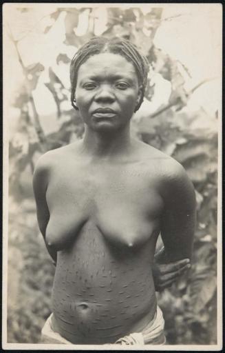 Half-length portrait of a woman with body scars