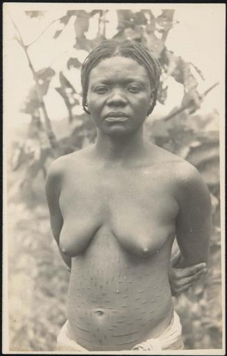 Half-length portrait of a woman with body scars