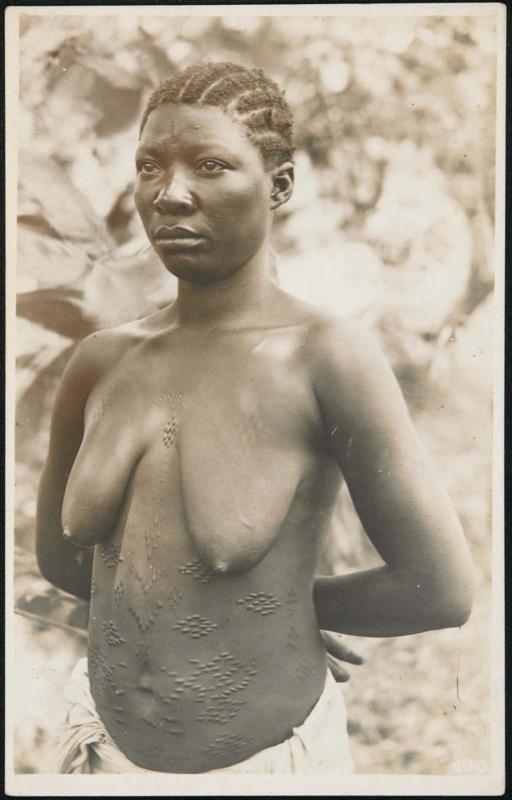 Half-length portrait of a woman with body scars