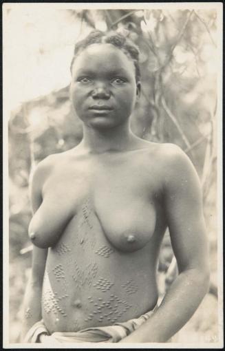 Half-length portrait of a woman with body scars
