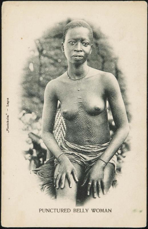 PUNCTURED BELLY WOMAN