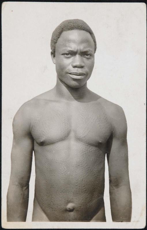 A.O.F. - GUINÉE. Tatouages Guerzé