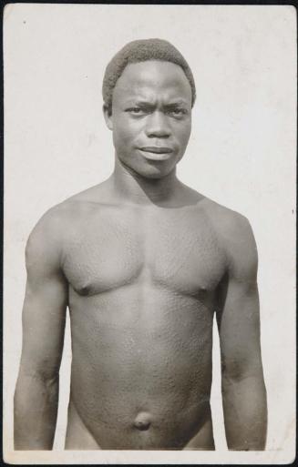 A.O.F. - GUINÉE. Tatouages Guerzé