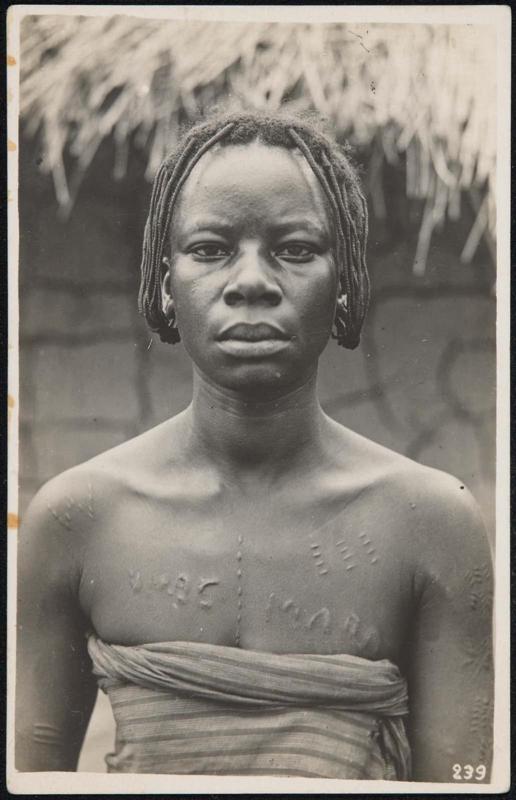 Bust portrait of a woman with body scars.