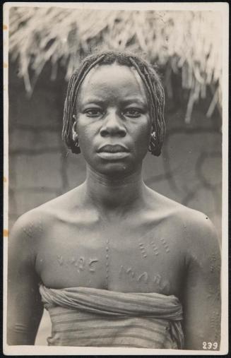 Bust portrait of a woman with body scars.