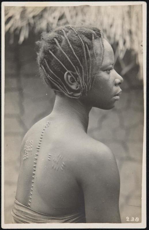 Bust portrait of a woman with body scars; from behind.