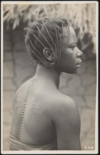 Bust portrait of a woman with body scars; from behind.