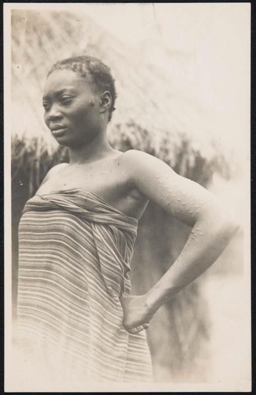 Half-length portrait of a woman in a dress.