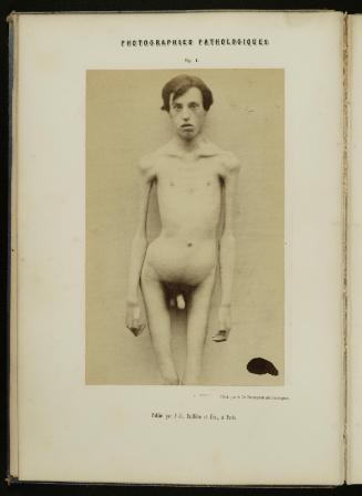 Album de photographies pathologiques complementaire du livre intitulé De l'electrisation localisée