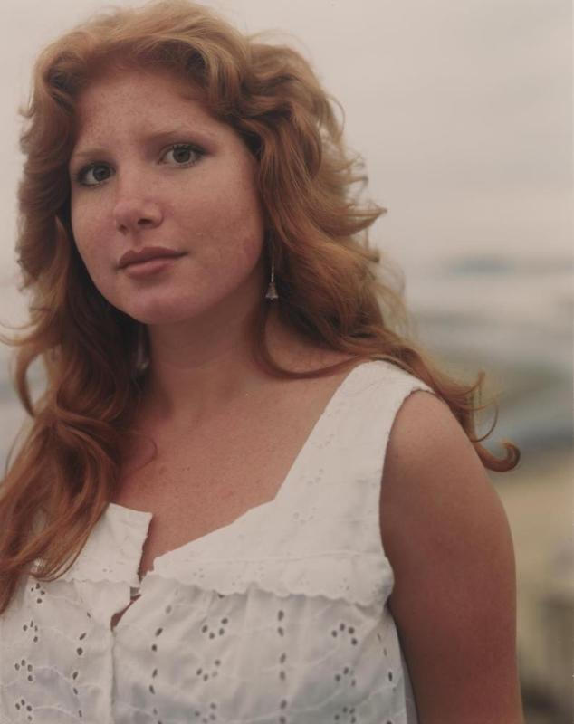 Stephanie, Heart-shaped birthmark
