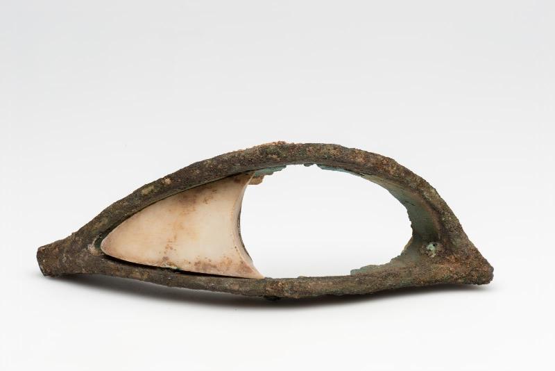 Eye inlay