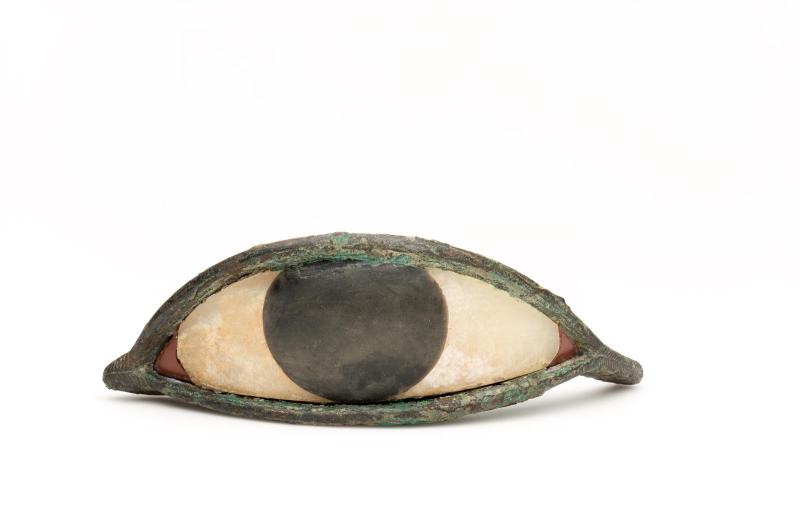 Eye inlay