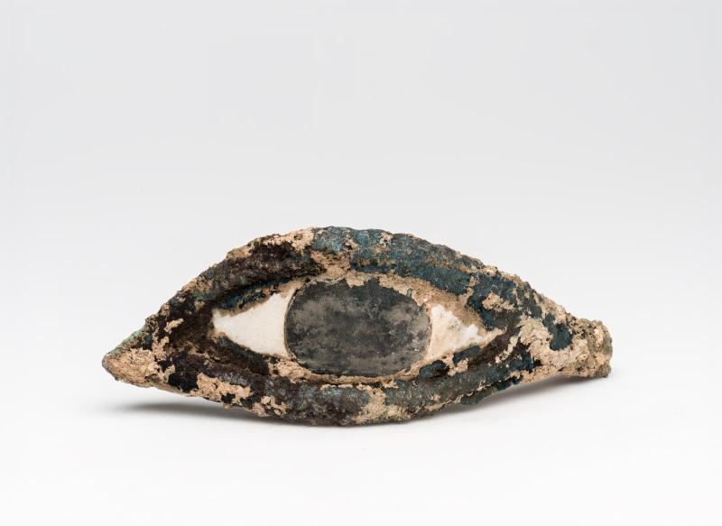 Eye inlay