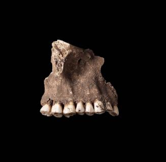 Half of human jaw