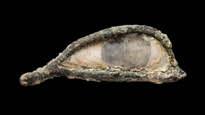 Eye inlay