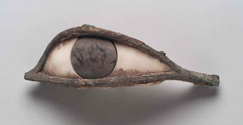 Eye inlay