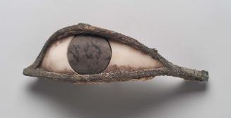 Eye inlay