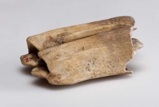 Bone