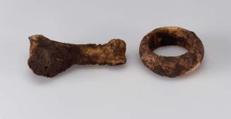 Ring on toe bone